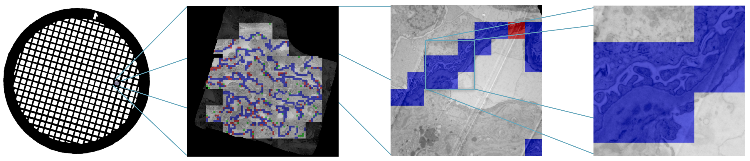 Research pictures of AI in medicine